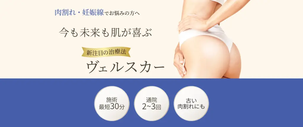 肉割れ治療のヴェルスカー