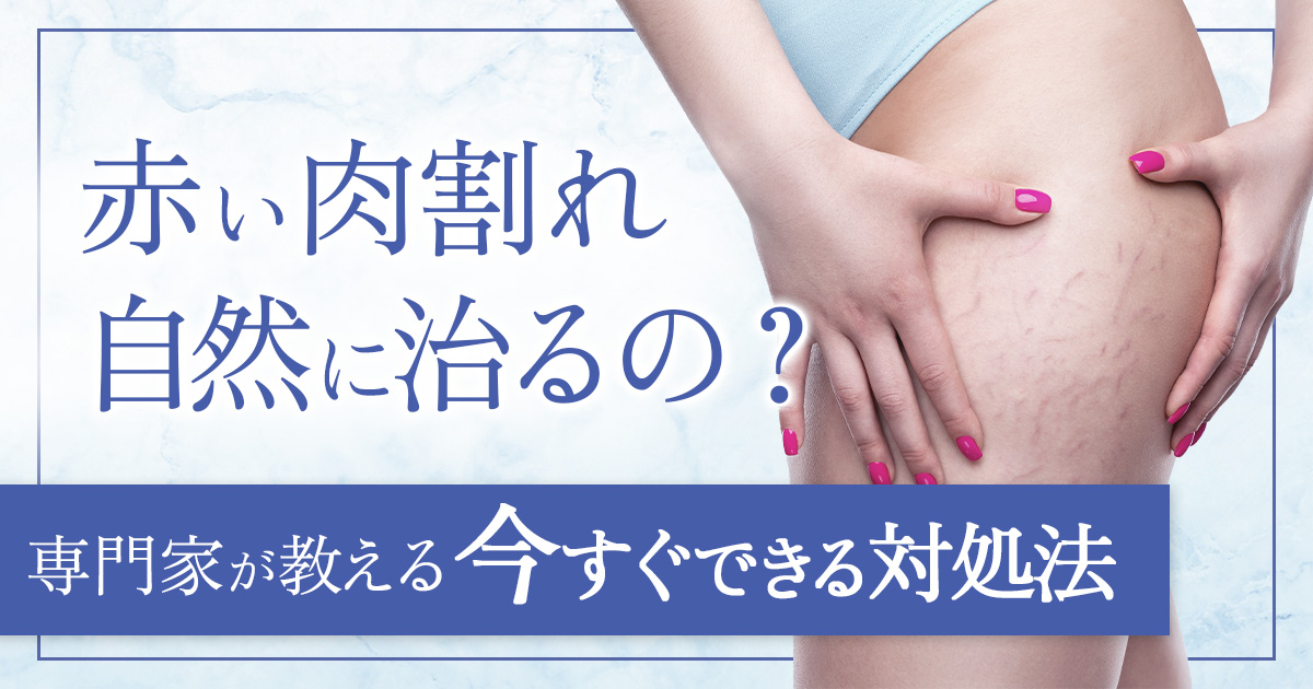 赤い肉割れの治し方は？赤いうちに対処すべき理由とよくある質問4選