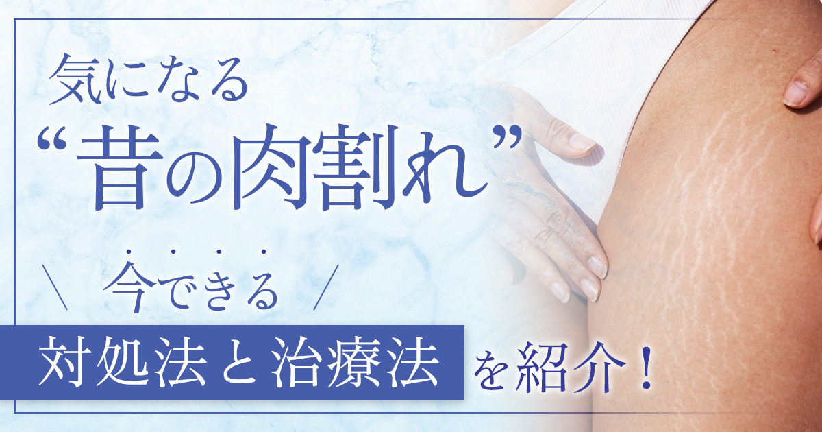 時間が経った古い肉割れがストレス、消すことはできる?適切な治療法を解説