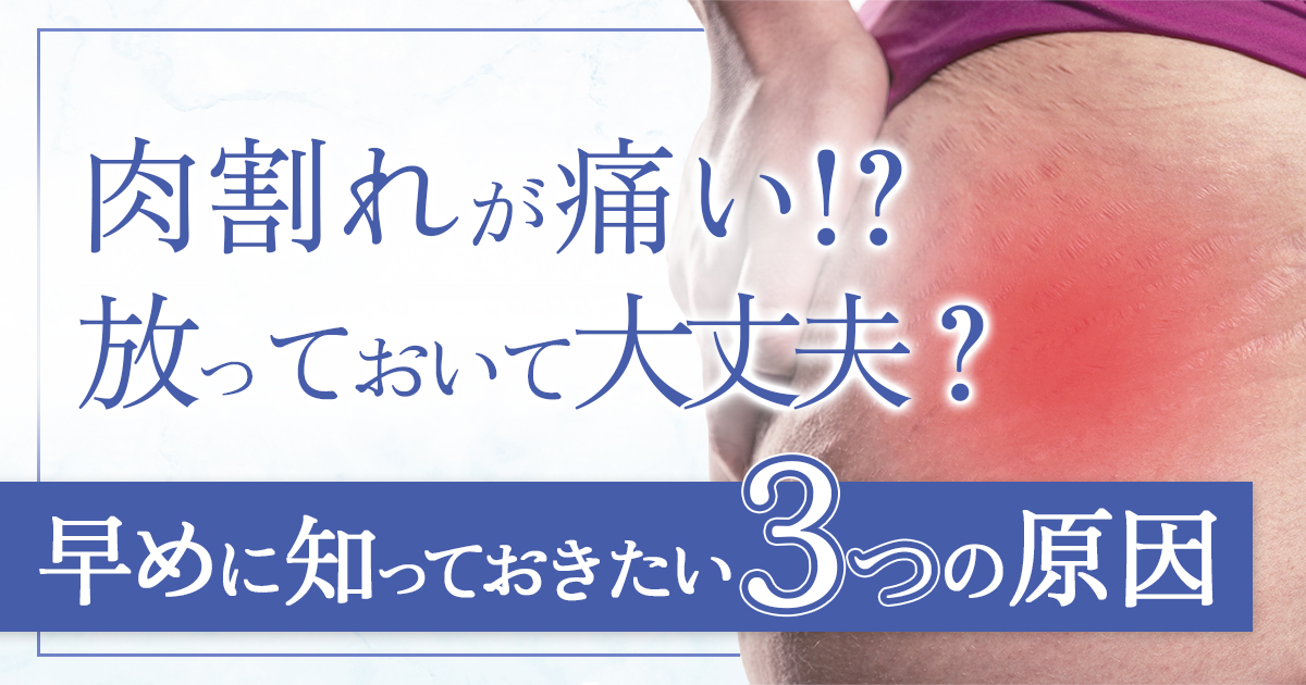 肉割れが痛い・ピリピリする原因は3つ!対処法や受診の目安も解説