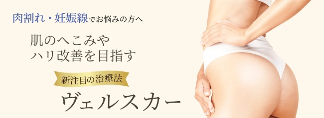 ヴェルスカーという治療法