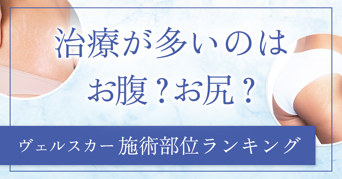 ヴェルスカー施術部位ランキングTOP10!肉割れが多いのはどこ?