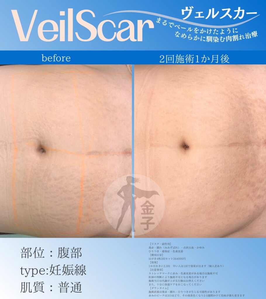 お腹の症例画像2