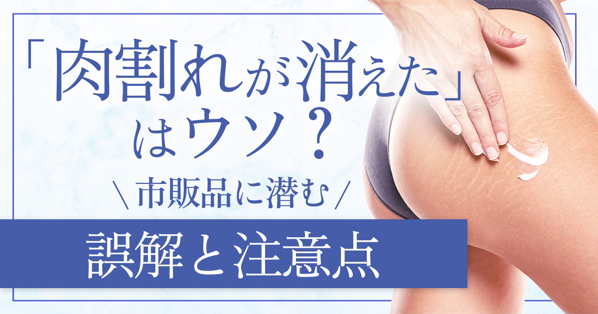 肉割れが消えた市販クリームには要注意!その理由と正しい治療法を解説