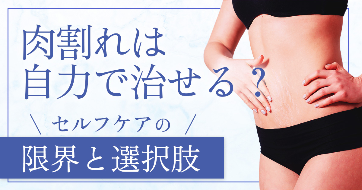 肉割れは自力で治すことはできる？治せるケースと対処法の注意点