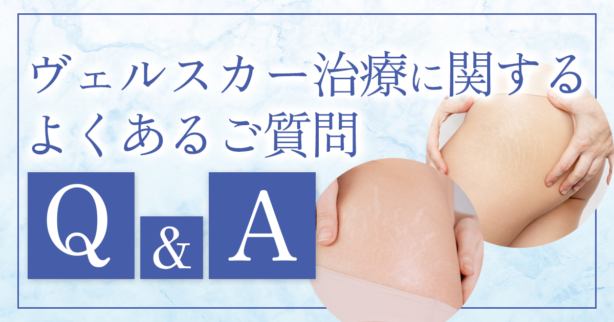 ヴェルスカー治療に関するよくある質問!肉割れ治療前に知っておきたいこと
