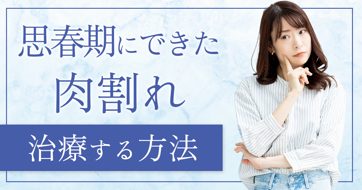 中学生の頃にできた肉割れは大人になってから治せる？治療のタイミングと注意点
