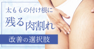 肉割れが太ももの付け根にできたときの治し方！原因と改善法まとめ