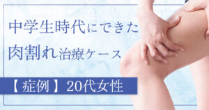 ヴェルスカー症例紹介