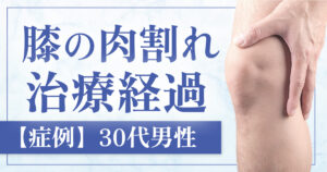 【症例】男性の膝の肉割れ治療セルフダーマ後の炎症と色素沈着を伴うケース