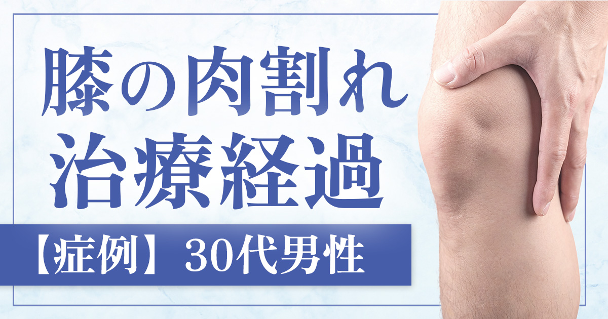 【症例】男性の膝の肉割れ治療セルフダーマ後の炎症と色素沈着を伴うケース