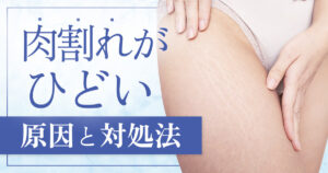 肉割れがひどいのはなぜ？原因と対処法・治療で改善を目指す方法
