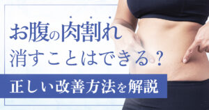 お腹の肉割れを消す方法はあるの？妊娠線も含めた正しい対処法を解説