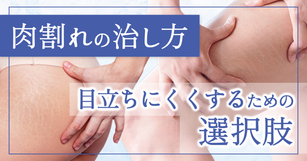 肉割れの治し方！自分に合った方法をわかりやすく解説