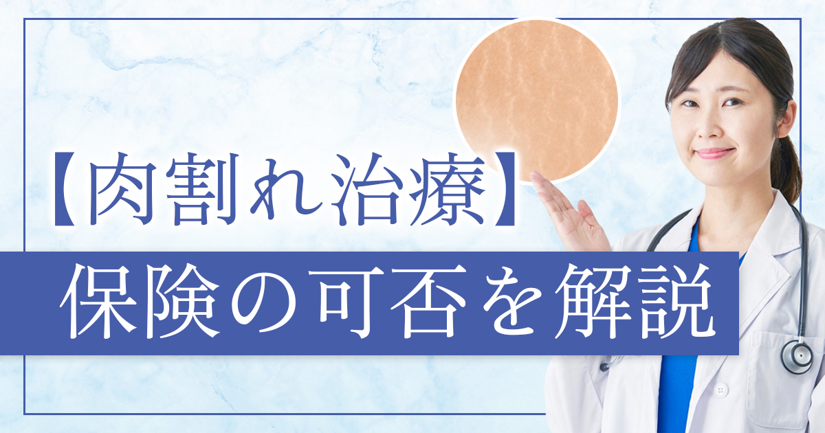 肉割れの治療は保険適用になる？ならない？理由と対処法