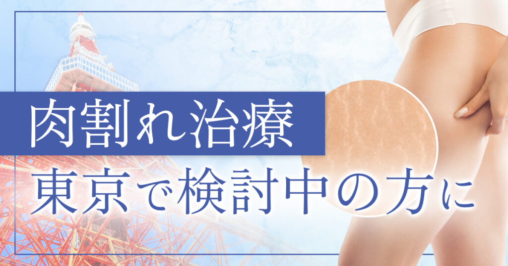 肉割れ治療を東京で検討している方へ！治療選びの考え方と選択肢