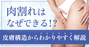 肉割れはなぜできる？皮膚の内側で起こる仕組みをわかりやすく解説