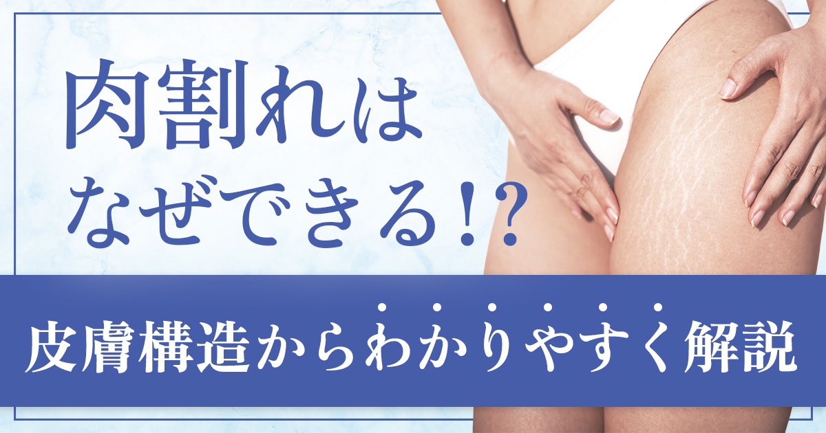 肉割れはなぜできる？皮膚の内側で起こる仕組みをわかりやすく解説