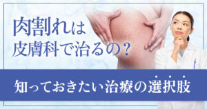白くなった肉割れは皮膚科で治るの？知っておきたい治療の考え方