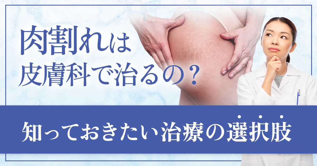 白くなった肉割れは皮膚科で治るの?知っておきたい治療の考え方