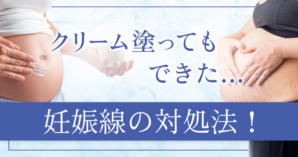 妊娠線クリームを塗ってもできた…それでも今から検討できる治療法を解説