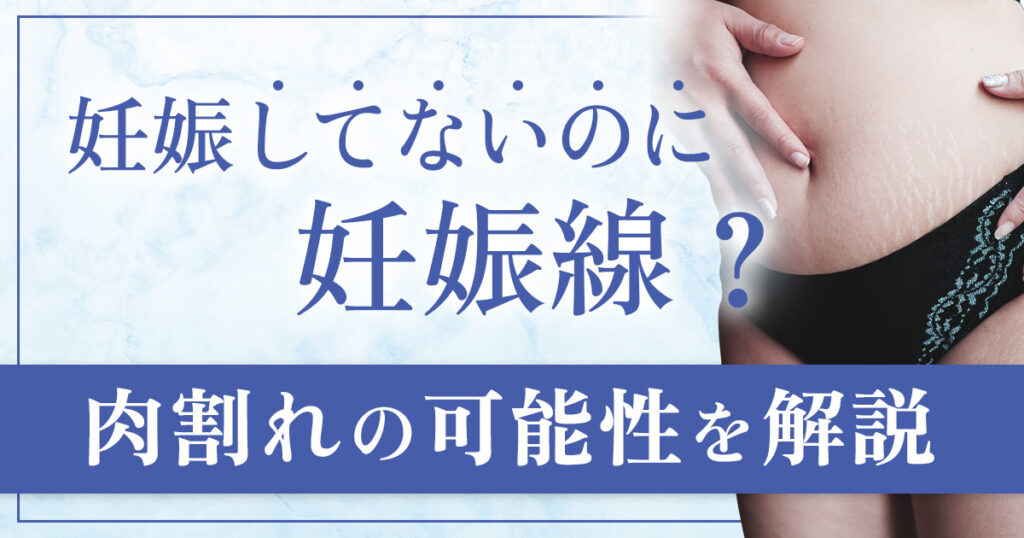 妊娠していないのに妊娠線が？肉割れなのか解説