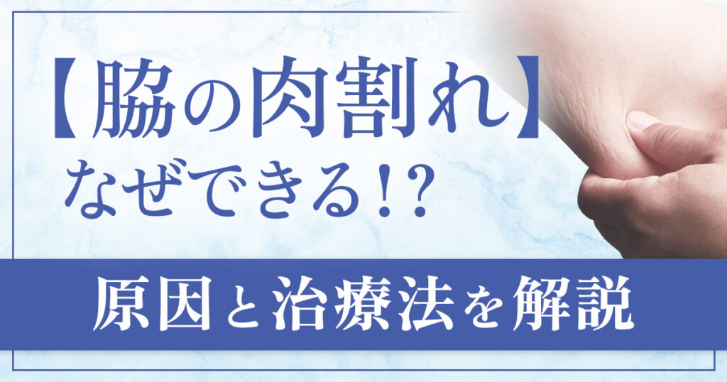 脇の肉割れはなぜできる？原因と治療について解説