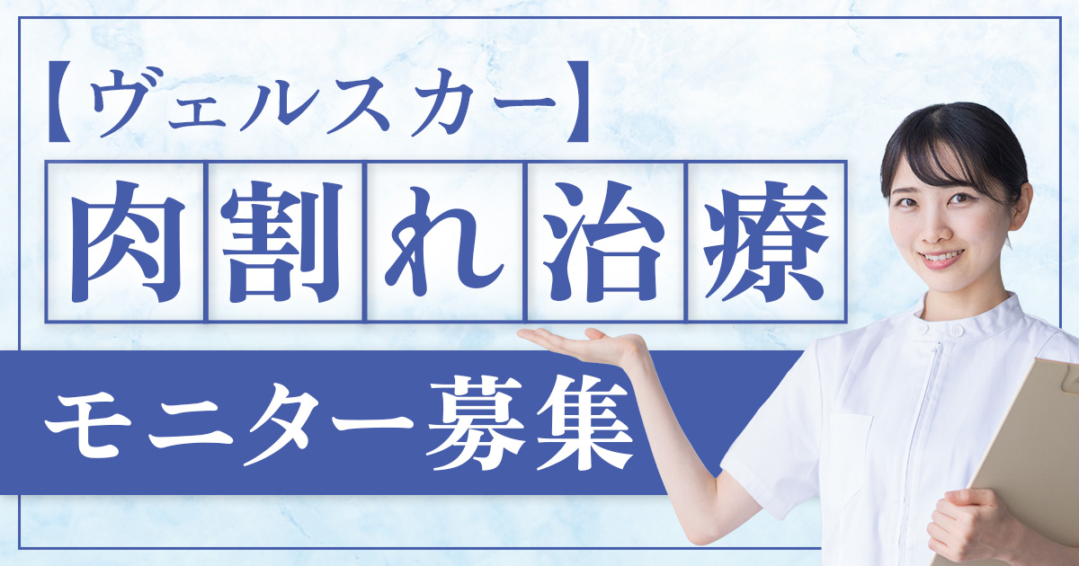 ヴェルスカー(肉割れ治療)モニター募集について