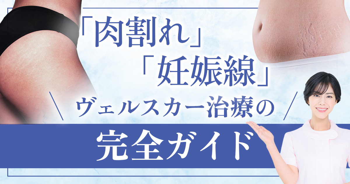 肉割れ・妊娠線ヴェルスカー治療の完全ガイド