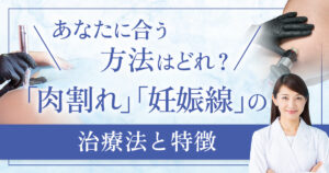 肉割れ(妊娠線)治療のおすすめは？主な治療法と特徴を解説