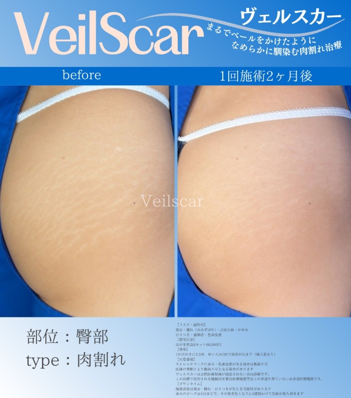 症例8京都から来院の20代女性