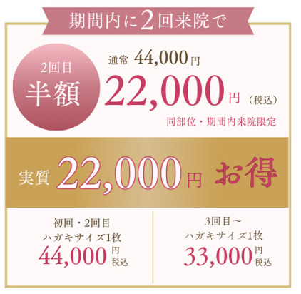 福岡キャンペーン料金