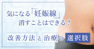 妊娠線を消すには？完全に消すのが難しい理由と目立ちにくくする考え方