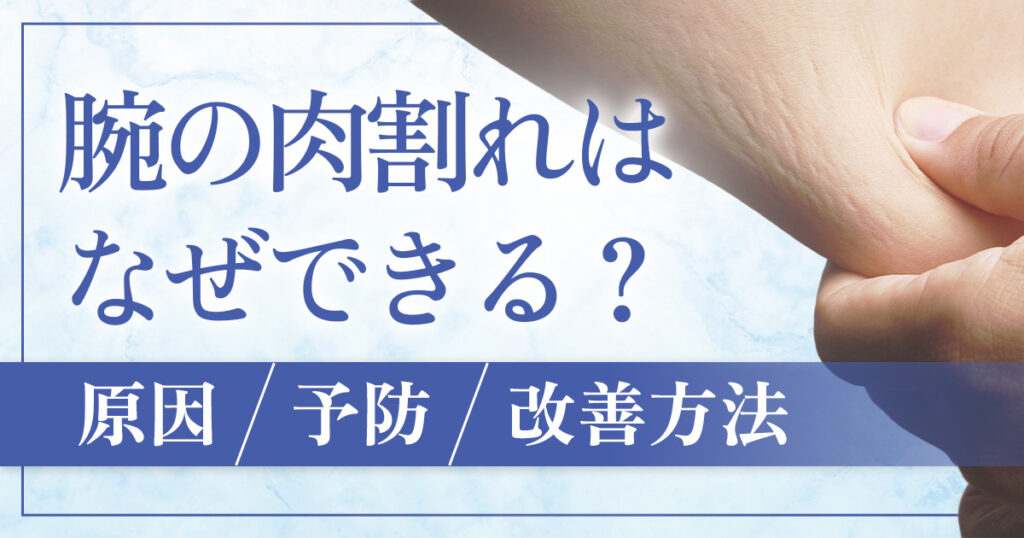 腕や二の腕の肉割れはなぜできる？原因と対策・治療法を解説