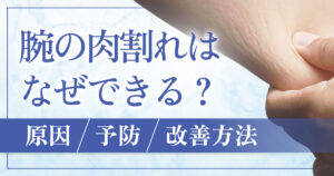 腕や二の腕の肉割れはなぜできる？原因と対策・治療法を解説