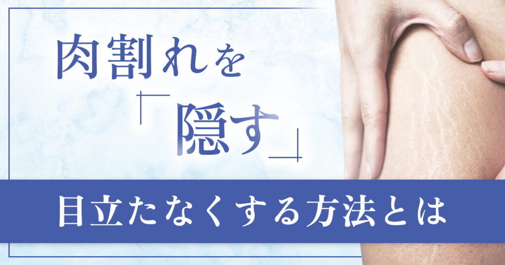 肉割れを服装以外で隠すには？メイクの注意点と治療の選択肢