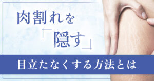 肉割れを服装以外で隠すには？メイクの注意点と治療の選択肢