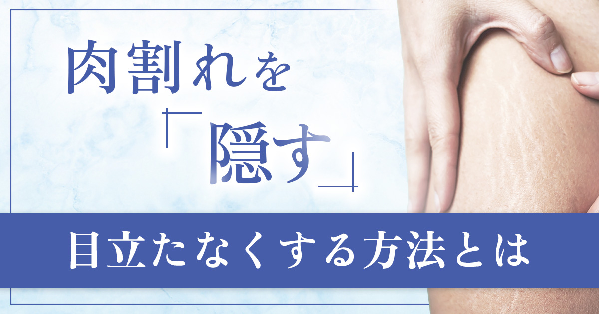 肉割れを服装以外で隠すには?メイクの注意点と治療の選択肢
