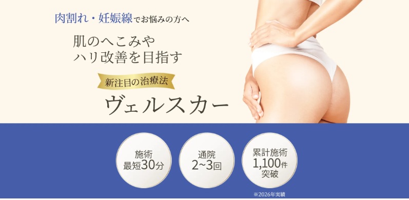 ヴェルスカー治療とは