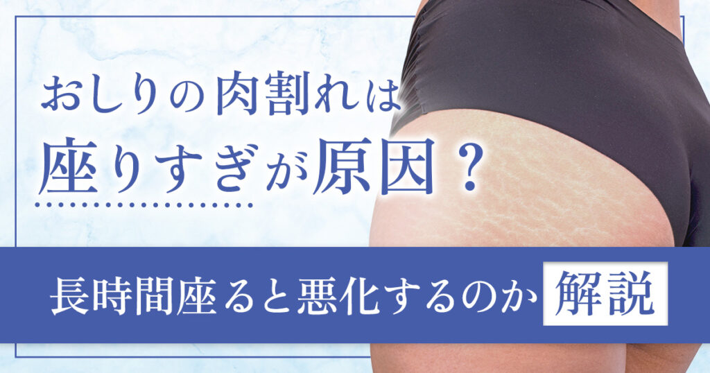 おしりの肉割れは座りすぎが原因？長時間座ると悪化するのか解説