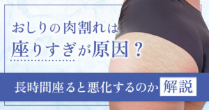 おしりの肉割れは座りすぎが原因？長時間座ると悪化するのか解説
