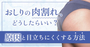 おしりの肉割れを治すには？原因と目立ちにくくする方法を解説