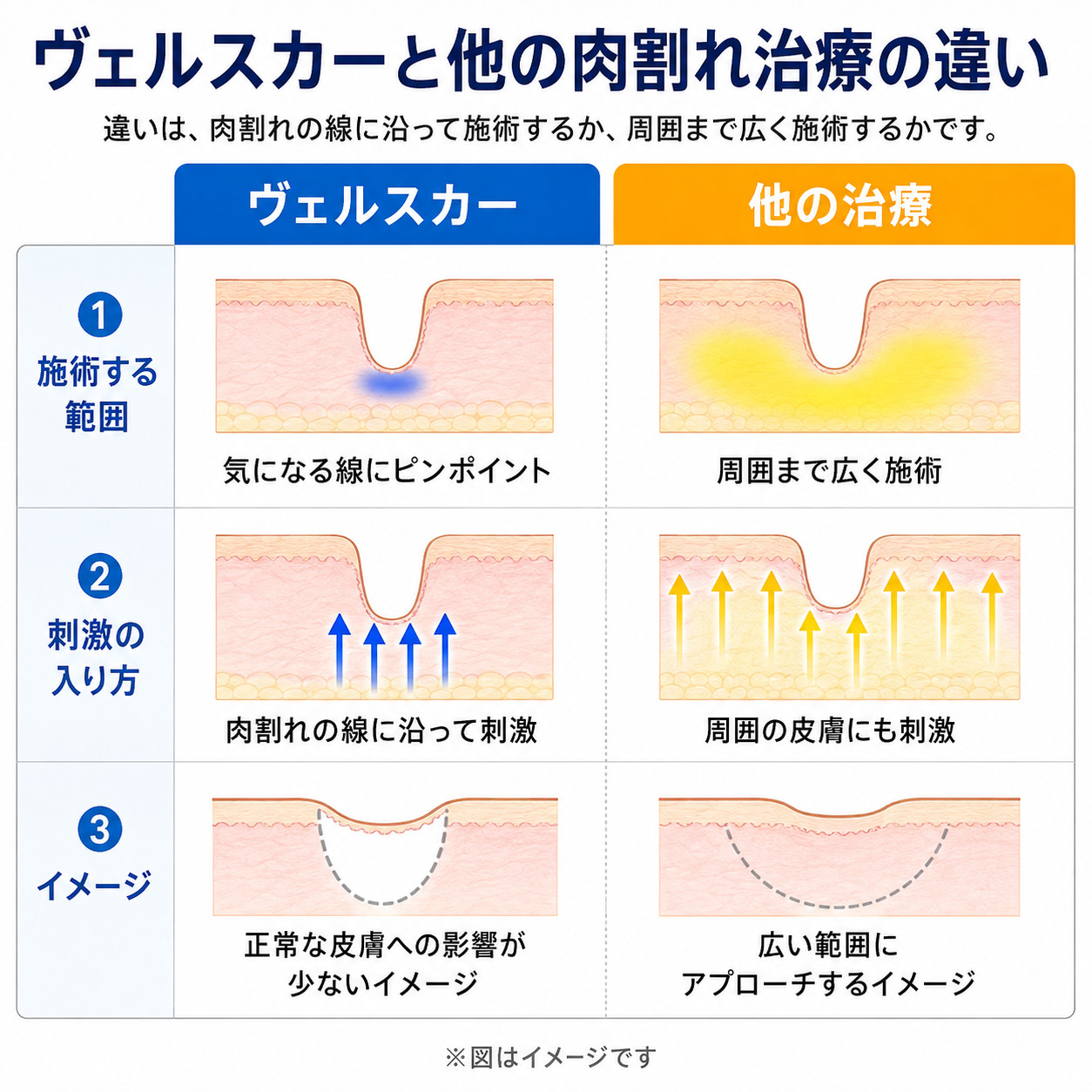 ヴェルスカーと他の肉割れ治療の違い
