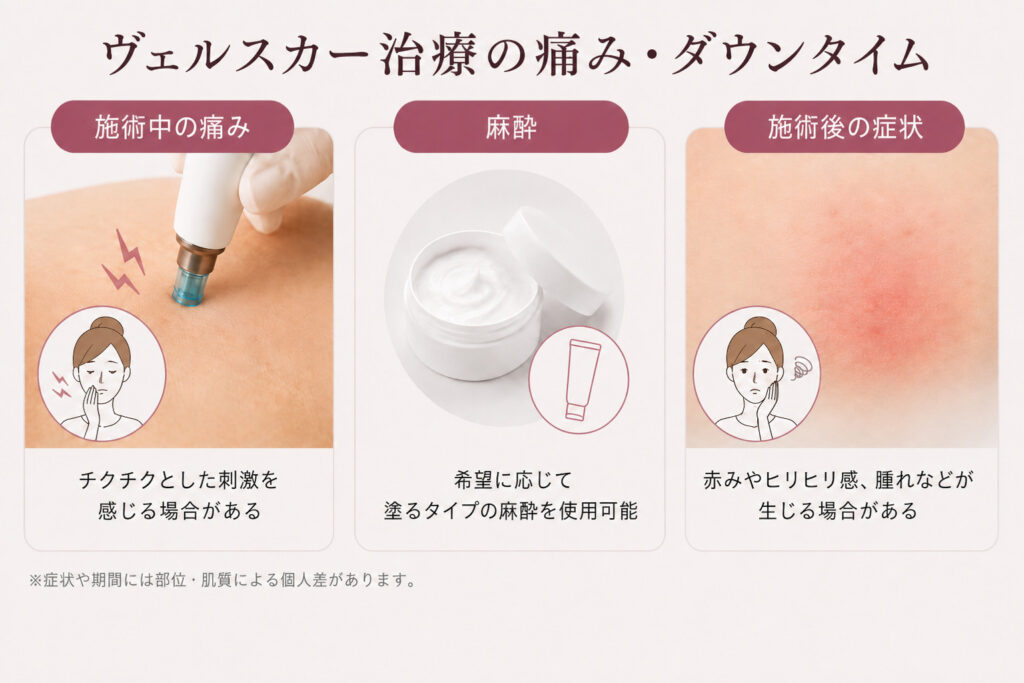 ヴェルスカーの痛みとダウンタイム