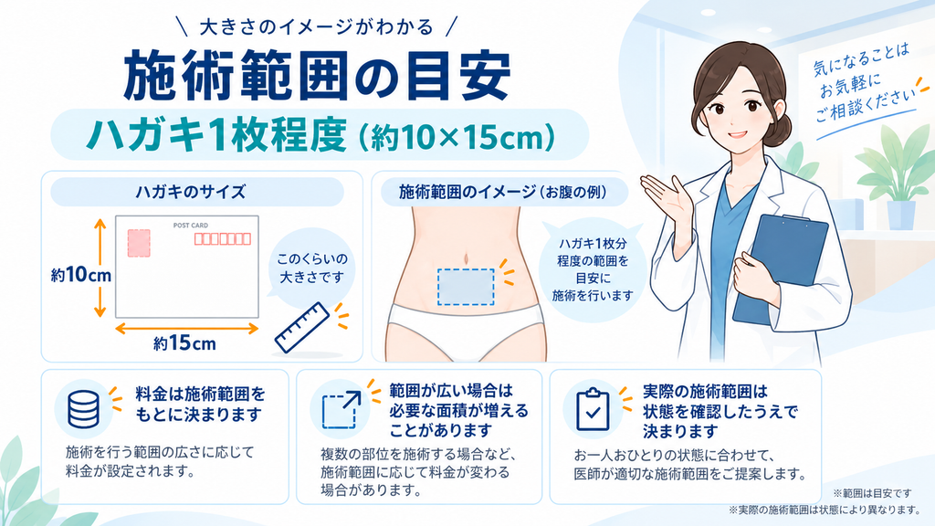 ヴェルスカー料金