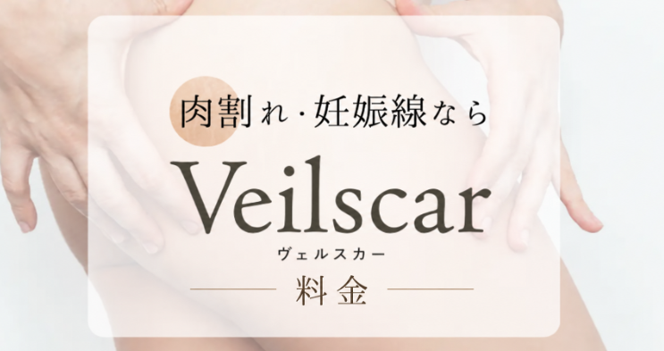 ヴェルスカー料金・費用