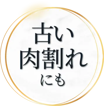 古い肉割れ