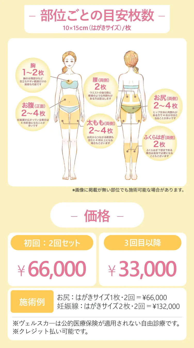 部位ごとの枚数目安と価格